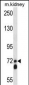 APLP2 Antibody (C-term)